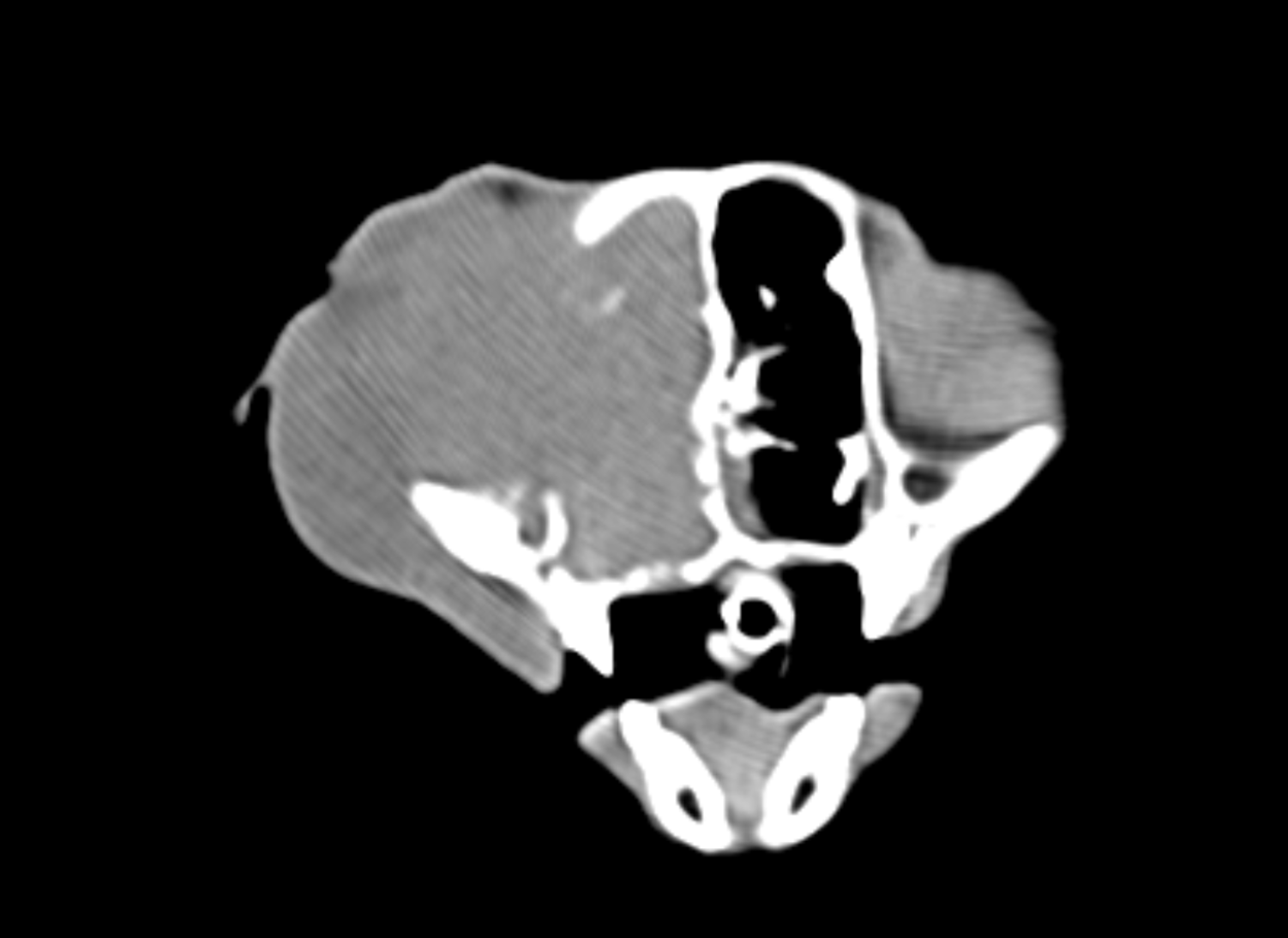 CT Nasal Example Image 3